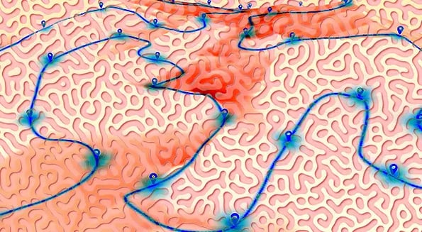 Australian startup raises $30m to map our brains